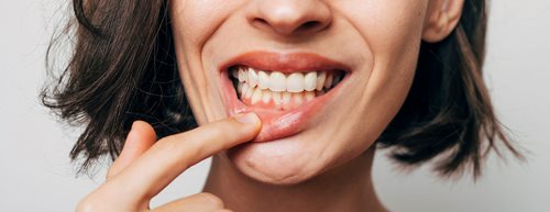 Preberite, kateri so po mnenju zobozdravnikov vzroki za krvavenje dlesni